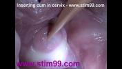 Video sex hot Insertion Semen Cum in Cervix Wide Stretching Pussy Speculum of free in TubeXxvideo.Com