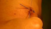 Download video sex hot Play piercing with acupuncture needles 1 high quality