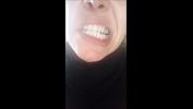 Watch video sex 2020 beautiful face comma but rotten teeth excl online high speed