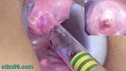 Video sex hot Woman Pee Hole Playing comma Urethral Insertion with Endoscope Cam of free