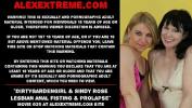 Free download video sex 2020 Dirtygardengirl amp Sindy Rose lesbian anal fisting and prolapse extreme in TubeXxvideo.Com