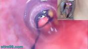 Video porn hot Mature Woman Peehole Endoscope Camera in Bladder with Balls online - TubeXxvideo.Com