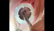 Watch video sex 2022 Watch 8mm electrosound puckering my cervix as I squeal from pain fastest of free