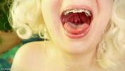 Free download video sex new braces mouth tour vore fetish close up